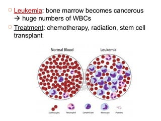  Leukemia: bone marrow becomes cancerous
 huge numbers of WBCs
 Treatment: chemotherapy, radiation, stem cell
transplant
 
