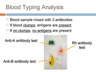 Blood Typing Analysis
 Blood sample mixed with 3 antibodies
 If blood clumps, antigens are present
 If no clumps, no antigens are present
Anti-A antibody testAnti-A antibody test
Anti-B antibody testAnti-B antibody test
Rh antibodyRh antibody
testtest
 