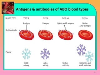 Antigens & antibodies of ABO blood types
41
 