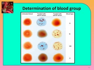 Determination of blood group
42
 