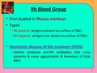 19-
44
Rh Blood Group
• First studied in Rhesus monkeys
• Types
– Rh positive: antigens present on surface of RBCs
– Rh negative: antigens are absent on surface of RBCs
• Hemolytic disease of the newborn (HDN)
– Mother produces anti-Rh antibodies that cross
placenta & cause agglutination & hemolysis of fetal
RBCs
 