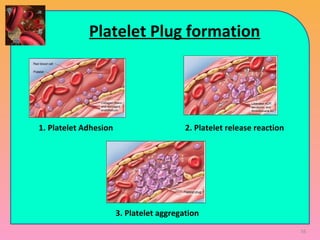 Platelet Plug formation
1. Platelet Adhesion 2. Platelet release reaction
3. Platelet aggregation
56
 