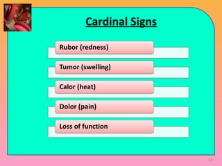 Cardinal Signs
63
 