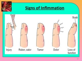 Signs of Inflmmation
64
 