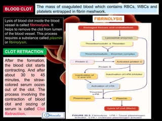 BLOOD CLOT
The mass of coagulated blood which contains RBCs, WBCs and
platelets entrapped in fibrin meshwork.
CLOT RETRACTION
After the formation,
the blood clot starts
contracting. And after
about 30 to 45
minutes, the straw-
colored serum oozes
out of the clot. The
process involving the
contraction of blood
clot and oozing of
serum is called Clot
Retraction.
FIBRINOLYSISLysis of blood clot inside the blood
vessel is called fibrinolysis. It
helps to remove the clot from lumen
of the blood vessel. This process
requires a substance called plasmin
or fibrinolysin.
 