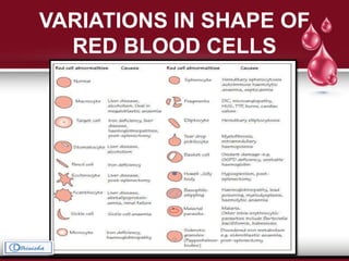 VARIATIONS IN SHAPE OF
RED BLOOD CELLS
 