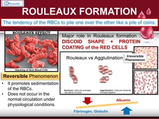 ROULEAUX FORMATION
The tendency of the RBCs to pile one over the other like a pile of coins.
Major role in Rouleaux formation :
DISCOID SHAPE + PROTEIN
COATING of the RED CELLS
Reversible Phenomenon
• It promotes sedimentation
of the RBCs.
• Does not occur in the
normal circulation under
physiological conditions.
Irreversible
Phenomenon
Albumin
Fibrinogen, Globulin
 