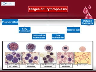 Stages of Erythropoiesis
Proerythroblast
Early
Normoblast
Intermediate
Normoblast
Late
Normoblast
Reticulocyte
Matured
Erythrocyte
 