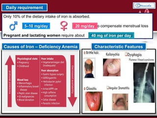 Only 10% of the dietary intake of iron is absorbed.
to compensate menstrual loss
Pregnant and lactating women require about
Daily requirement
5–10 mg/day 20 mg/day
40 mg of iron per day
Causes of Iron – Deficiency Anemia Characteristic Features
 