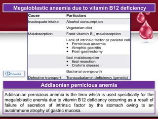 Megaloblastic anaemia due to vitamin B12 deficiency
 