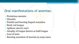 Oral manifestations of anemias:
• Pernicious anemia:
• Glossitis
• Painful and burning lingual sensation
• Beefy red tongue
• Apthous ulcers( rare)
• Atrophy of tongue known as bald tongue
• Loss of taste
• Burning sensation of mucosa in some cases
 