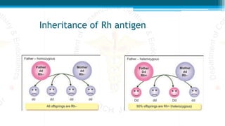 Inheritance of Rh antigen
 