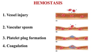 HEMOSTASIS
1. Vessel injury
2. Vascular spasm
3. Platelet plug formation
4. Coagulation
 