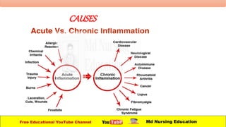CAUSES
Free Educational YouTube Channel Md Nursing Education
 