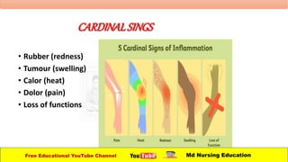 CARDINALSINGS
• Rubber (redness)
• Tumour (swelling)
• Calor (heat)
• Dolor (pain)
• Loss of functions
Free Educational YouTube Channel Md Nursing Education
 