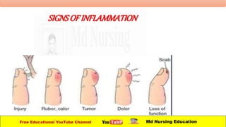 SIGNSOFINFLAMMATION
Free Educational YouTube Channel Md Nursing Education
 