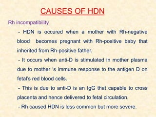CAUSES OF HDN
Rh incompatibility
- HDN is occured when a mother with Rh-negative
blood becomes pregnant with Rh-positive baby that
inherited from Rh-positive father.
- It occurs when anti-D is stimulated in mother plasma
due to mother ‘s immune response to the antigen D on
fetal’s red blood cells.
- This is due to anti-D is an IgG that capable to cross
placenta and hence delivered to fetal circulation.
- Rh caused HDN is less common but more severe.
 