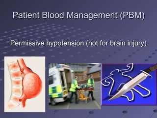 Patient Blood Management (PBM)Patient Blood Management (PBM)
Permissive hypotension (not for brain injury)Permissive hypotension (not for brain injury)
 