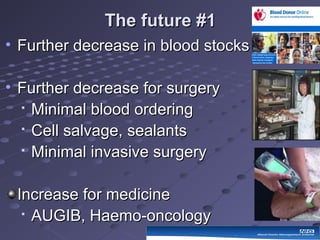 The future #1The future #1
• Further decrease in blood stocksFurther decrease in blood stocks
• Further decrease for surgeryFurther decrease for surgery

Minimal blood orderingMinimal blood ordering

Cell salvage, sealantsCell salvage, sealants

Minimal invasive surgeryMinimal invasive surgery
Increase for medicineIncrease for medicine

AUGIB, Haemo-oncologyAUGIB, Haemo-oncology
 