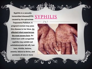 Syphilis is a sexually
 transmitted disease(STD)
 caused by the spirochete
                                    SYPHILIS
   Treponema Pallidum. A
pregnant woman may pass
this disease to her fetus. An
affected infant experiences
  the most severe form. An
infant born with congenital
  syphilis may exhibit nail
exfoliation(nails fall off), hair
    loss, rhinitis, lesions,
anemia, failure to thrive, and
  paralysis of one or more
            limbs.
 