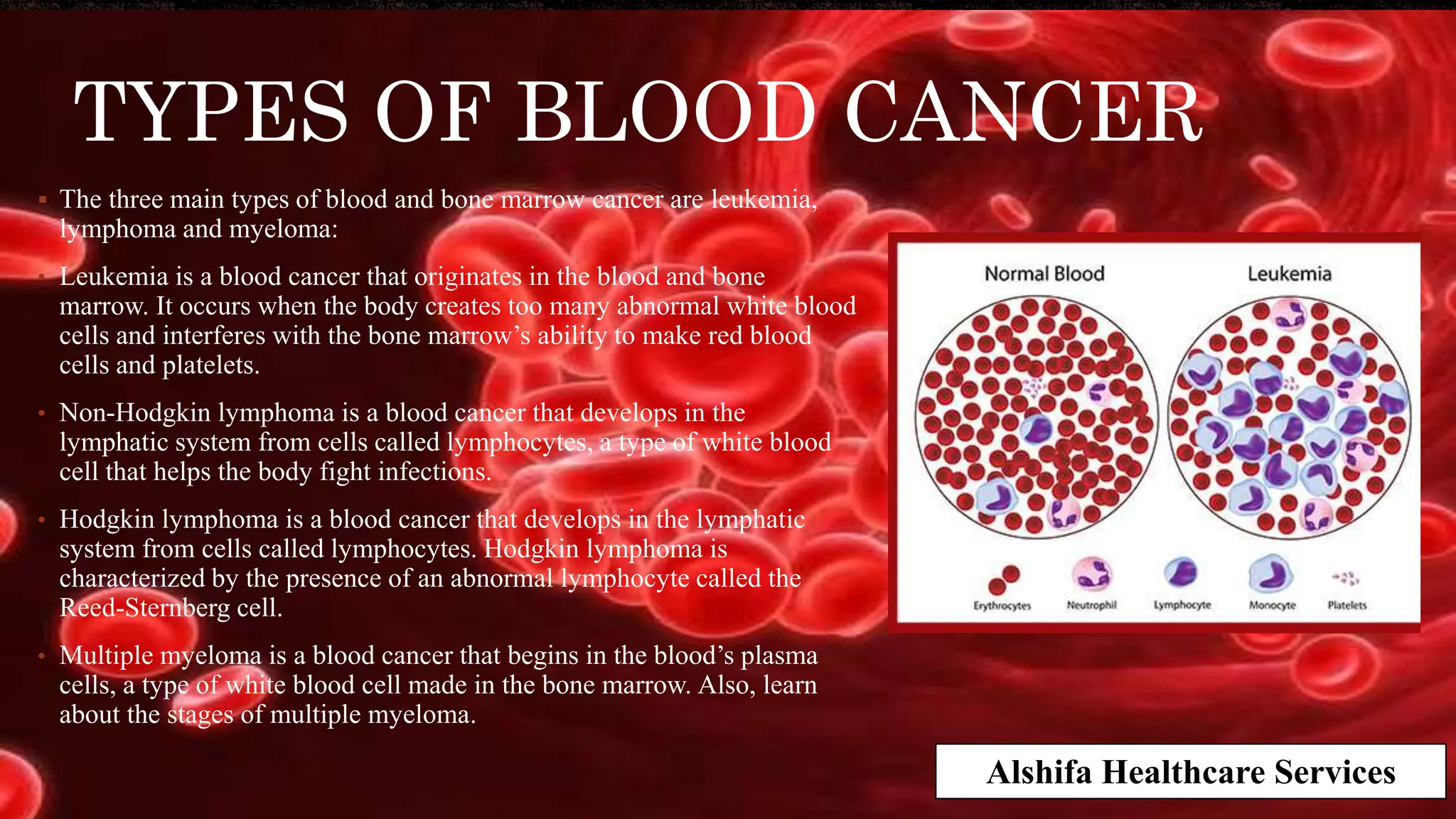 Blood Cancer Treatment | Best Blood cancer treatment in India | PPTX