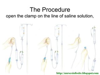 The Procedure
open the clamp on the line of saline solution,




                          http://nursesinfosite.blogspot.com
 