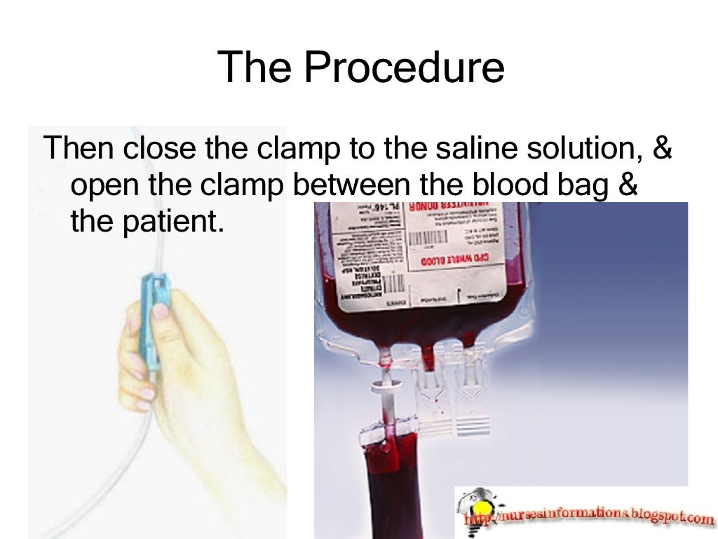Blood Transfusion A Routine Medical Procedure