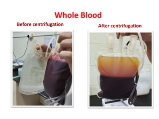 Whole Blood
Before centrifugation After centrifugation
 