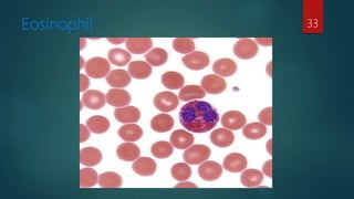 Eosinophil 33
 