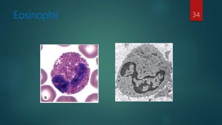 Eosinophil 34
 