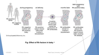 1/23/2021 Prof. Mukul Sharma Medi-Caps University, Indore 18
Fig: Effect of Rh factors in baby 11
 