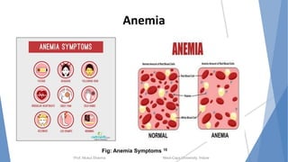Anemia
Prof. Mukul Sharma Medi-Caps University, Indore
Fig: Anemia Symptoms 10
 