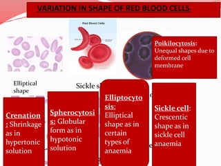 VARIATION IN SHAPE OF RED BLOOD CELLS:
Elliptical
shape
Sickle shape
poikiocytes
spherocytes
Spherocytosi
s: Globular
form as in
hypotonic
solution
Sickle cell:
Crescentic
shape as in
sickle cell
anaemia
Elliptocyto
sis:
Elliptical
shape as in
certain
types of
anaemia
Crenation
: Shrinkage
as in
hypertonic
solution
Poikilocytosis:
Unequal shapes due to
deformed cell
membrane
 