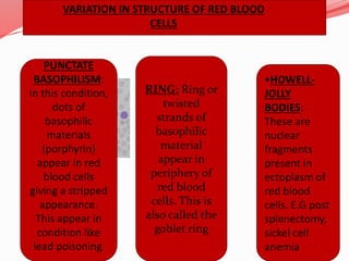 VARIATION IN STRUCTURE OF RED BLOOD
CELLS
Howell jolly bodies
PUNCTATE
BASOPHILISM:
In this condition,
dots of
basophilic
materials
(porphyrin)
appear in red
blood cells
giving a stripped
appearance.
This appear in
condition like
lead poisoning.
RING: Ring or
twisted
strands of
basophilic
material
appear in
periphery of
red blood
cells. This is
also called the
goblet ring
•HOWELL-
JOLLY
BODIES:
These are
nuclear
fragments
present in
ectoplasm of
red blood
cells. E.G post
splenectomy,
sickel cell
anemia
 