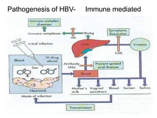 Pathogenesis of HBV-

Immune mediated

 