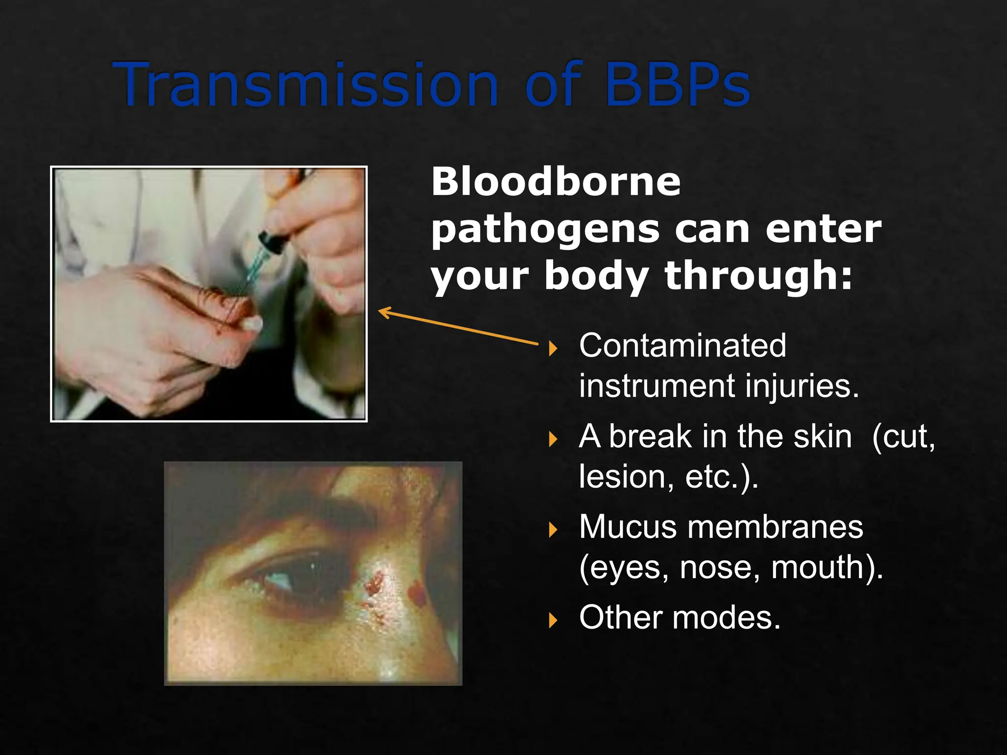 Contamination Instruments Bp4 Bloodborne Pathogens in a dental setup .ppt