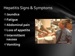 Hepatitis Signs & Symptoms
Jaundice
Fatigue
Abdominal pain
Loss of appetite
Intermittent
 nausea
Vomiting
 