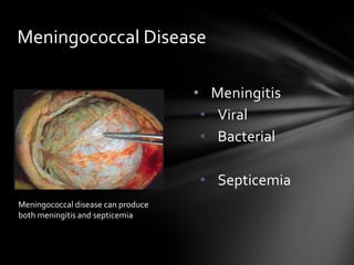 Meningococcal Disease

                                    • Meningitis
                                     • Viral
                                     • Bacterial

                                    • Septicemia
Meningococcal disease can produce
both meningitis and septicemia
 