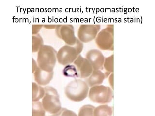 Trypanosoma cruzi, trypomastigote
form, in a blood smear (Giemsa stain)
 