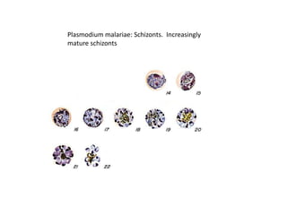 Plasmodium malariae: Schizonts. Increasingly
mature schizonts
 