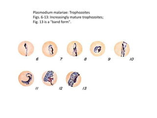 Plasmodium malariae: Trophozoites
Figs. 6-13: Increasingly mature trophozoites;
Fig. 13 is a "band form".
 