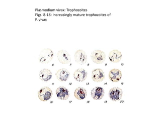 Plasmodium vivax: Trophozoites
Figs. 8-18: Increasingly mature trophozoites of
P. vivax
 