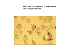 Stage II (central) and stage III (bottom right)
immature gametocytes
 