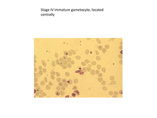Stage IV immature gametocyte, located
centrally
 