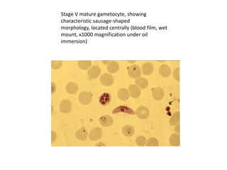 Stage V mature gametocyte, showing
characteristic sausage-shaped
morphology, located centrally (blood film, wet
mount, x1000 magnification under oil
immersion)
 