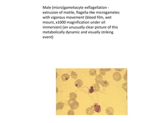 Male (micro)gametocyte exflagellation -
extrusion of motile, flagella-like microgametes
with vigorous movement (blood film, wet
mount, x1000 magnification under oil
immersion) (an unusually clear picture of this
metabolically dynamic and visually striking
event)
 