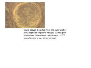 Single oocyst, dissected from the outer wall of
the Anopheles stephensi midgut, 10 days post
infection of the mosquito (wet mount, x1000
magnification under oil immersion)
 