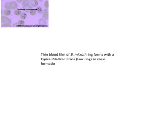 Thin blood film of B. microti ring forms with a
typical Maltese Cross (four rings in cross
formatio
 