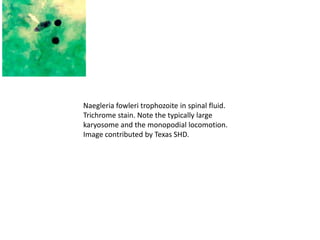 Naegleria fowleri trophozoite in spinal fluid.
Trichrome stain. Note the typically large
karyosome and the monopodial locomotion.
Image contributed by Texas SHD.
 