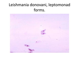 Leishmania donovani, leptomonad
forms.
 